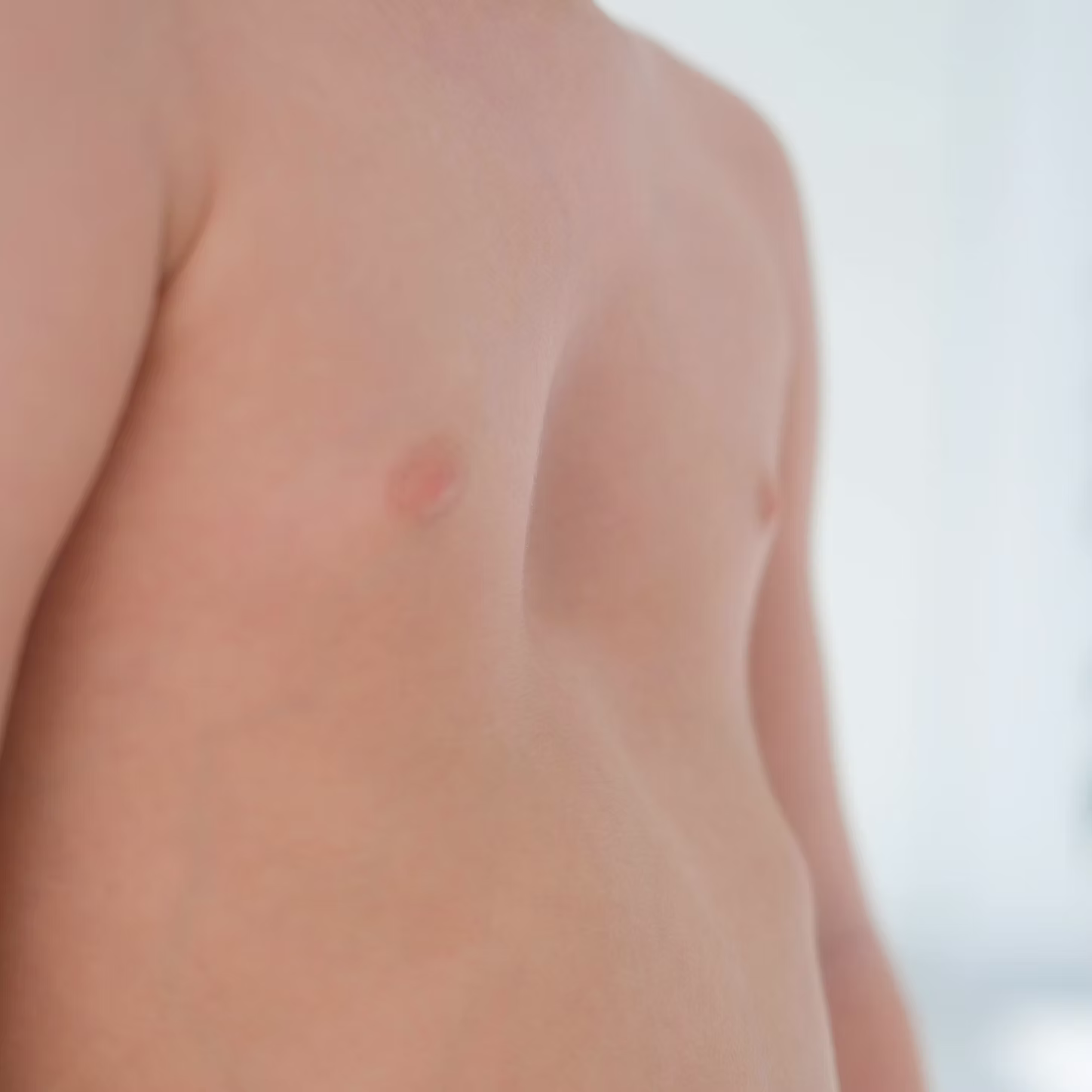 What special types of pectus excavatum(PE) are suitable for the Wang procedure?