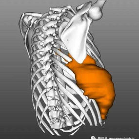 Location of the right chest wall tumor (lateral posterior view)