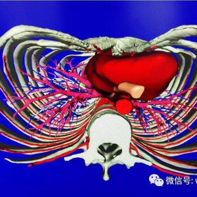 Adhesions between the mediastinum and the anterior chest wall