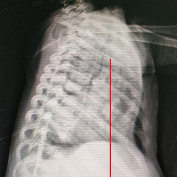 X-ray examination before the surgery