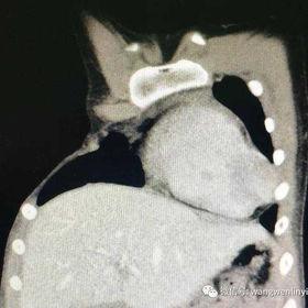 Image test before the surgery