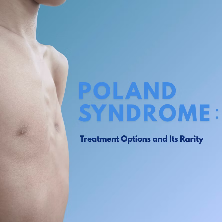 Exploring Poland Syndrome Treatment Options and Its Rarity