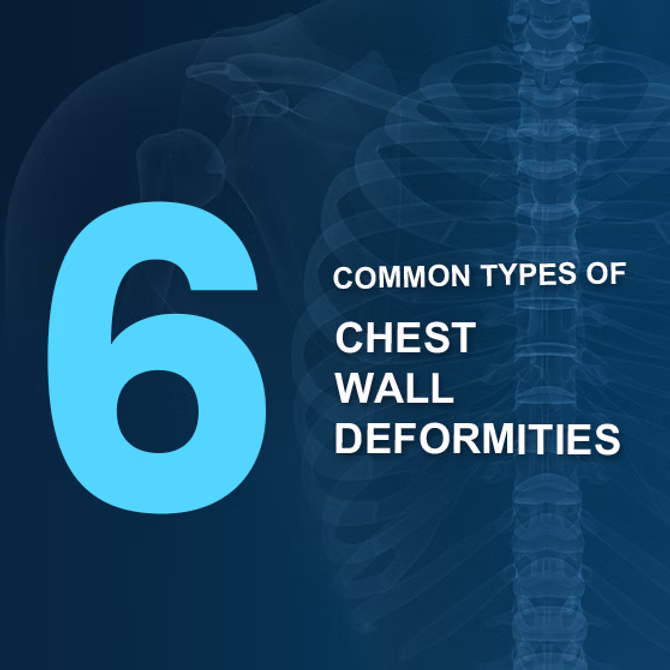 6 Common Types of Chest Wall Deformities